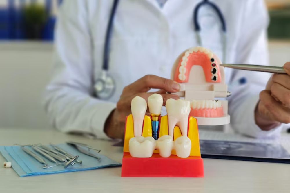 Dental implants in Mississauga replace missing teeth with strong, natural-looking results. Our dental implants near you restore comfort and confidence.